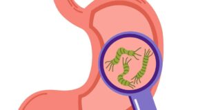 Infección por Helicobacter pylori. Qué recomiendan los especialistas en gastroenterología de Quito. 6 1200 stomack bacteria