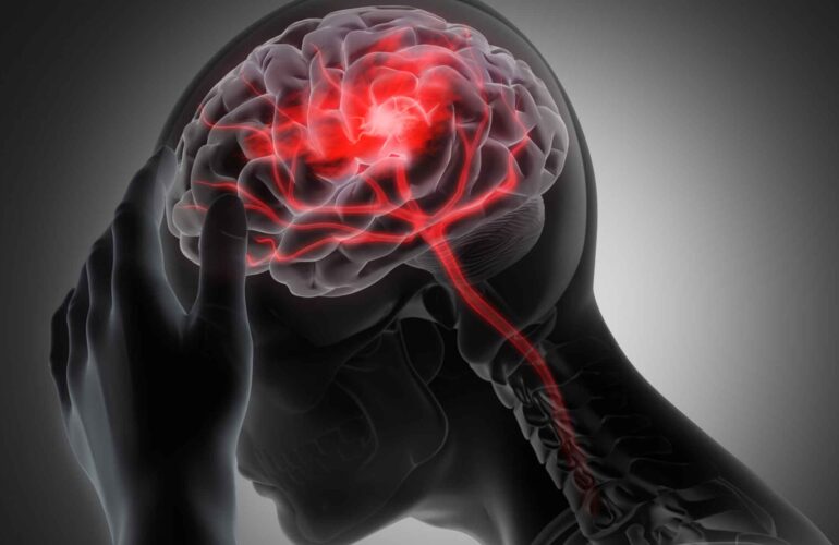 La Hora Dorada: Desde el inicio del Accidente Cerebrovascular hasta la Unidad de Cuidados Intensivos en Quito, la hora que puede salvar tu vida. 1 Sin titulo 2