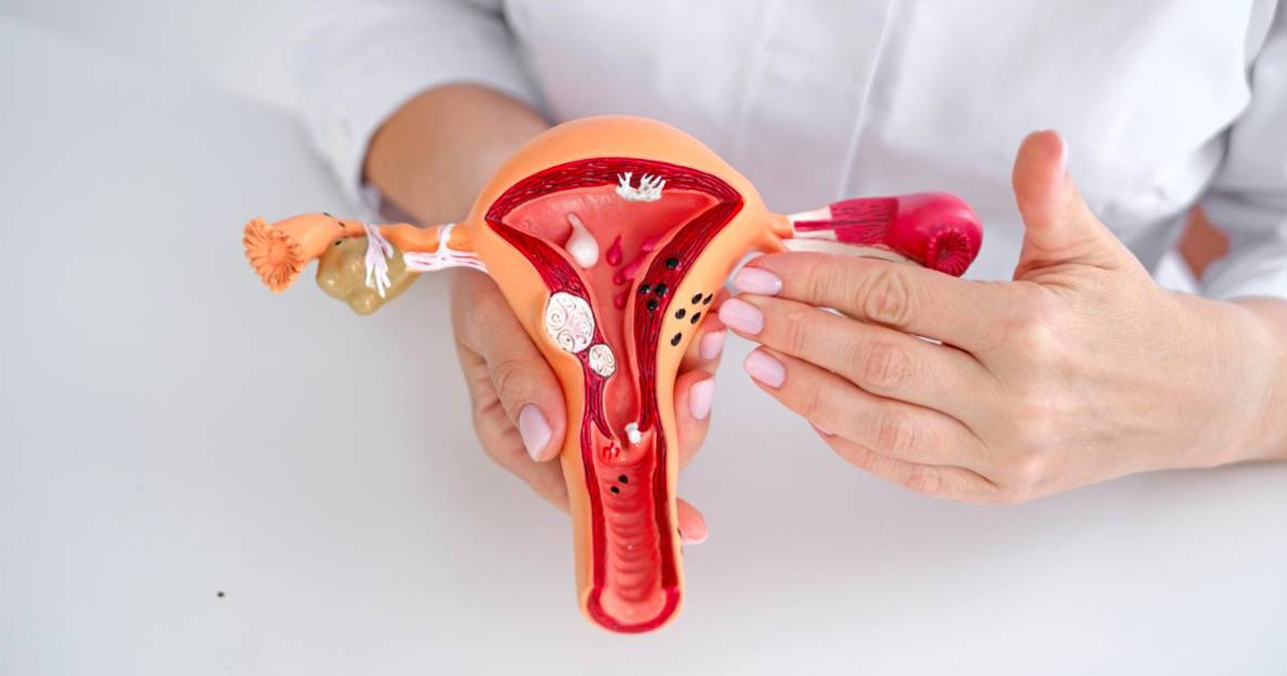 Endometriosis: Una enfermedad silenciosa que produce infertilidad y cómo la tratamos en Axxis Hospital Quito